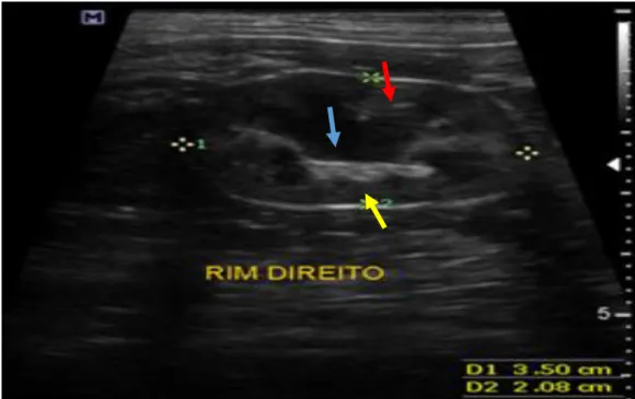 Figura 2. Ultrassonografia renal de um gato saudável. A seta azul indica a região medular renal
