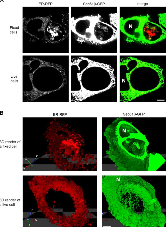 Fig 2. ER markers reveal expansive structures within the inclusion lumen of fixed but not living cells