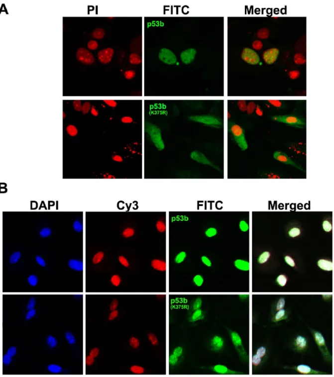 Figure 4. SUMO-1 modification of p53b at Lys 375 was required for its nuclear accumulation in granulosa cells