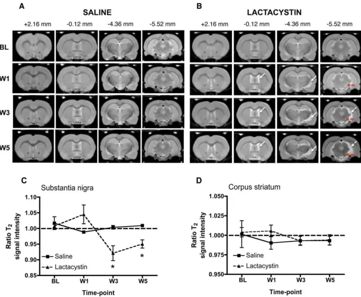 Figure 3. Representative longitudinal in vivo T2W MR images acquired from (A) saline-injected controls and (B) lactacystin-lesioned animals