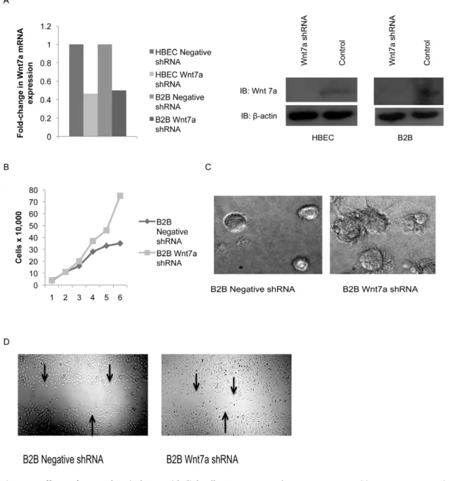 Figure 1. Effects of Wnt7a loss in lung epithelial cells. A) Expression of Wnt7a was measured by QPCR in HBEC and B2B cells after stable transfection with Wnt7a shRNA or a negative shRNA
