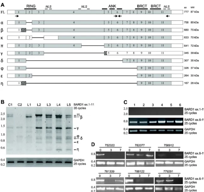 Figure 1.   Truncated BARD1 isoforms are highly expressed in human AML ex  vivo and  in vivo samples