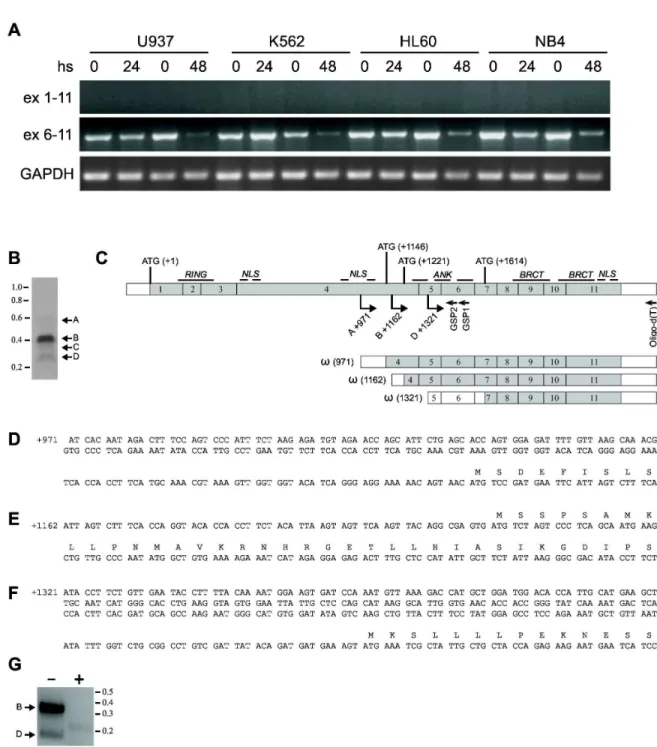 Figure  2.    Truncated  BARD1  isoform(s)  are  expressed  in  human  AML  cell  lines  and  their  expression  is  modulated  by HDACi treatment