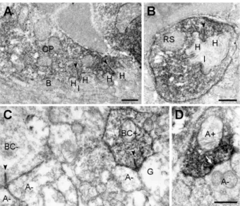 Figure 4. Presynaptic localization of ANO1 in the retina.