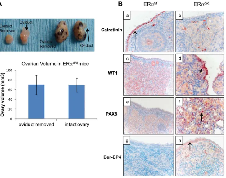 Figure 4. OSE is the site of origin for ovarian tumorigenesis in ER a d/d mice. (A) Ovarian tumor growth in ER a d/d mice after surgical removal of oviducts