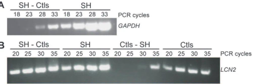 Figure 3. Differential hybridization screening. Representative differential screening results of macroarrays of the SH-Ctls library