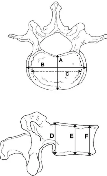 Figure 2. The site of the measurements in L4 vertebra. A: