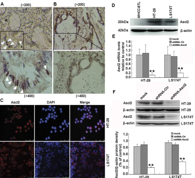 Figure 1. Expression of Ascl2 in normal human colon mucosa, colon cancer and colon cancer cell lines and its selective interference in HT-29 and LS174T cells