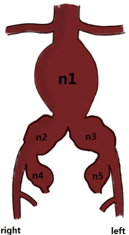 Fig 2. * n 1 : abdominal aortic aneurysm (AAA); n 2 : right common iliac artery aneurysm (CIAA); n 3 : left CIAA; n 4 : right internal iliac artery aneurysm (IIAA); and n 5 : left IIAA