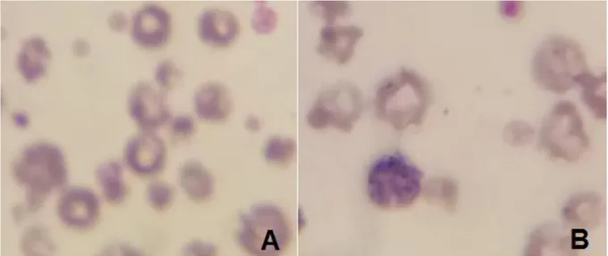 Figure 2. Blood smear showing intraerythrocytic bodies befitting with Anaplasma marginale