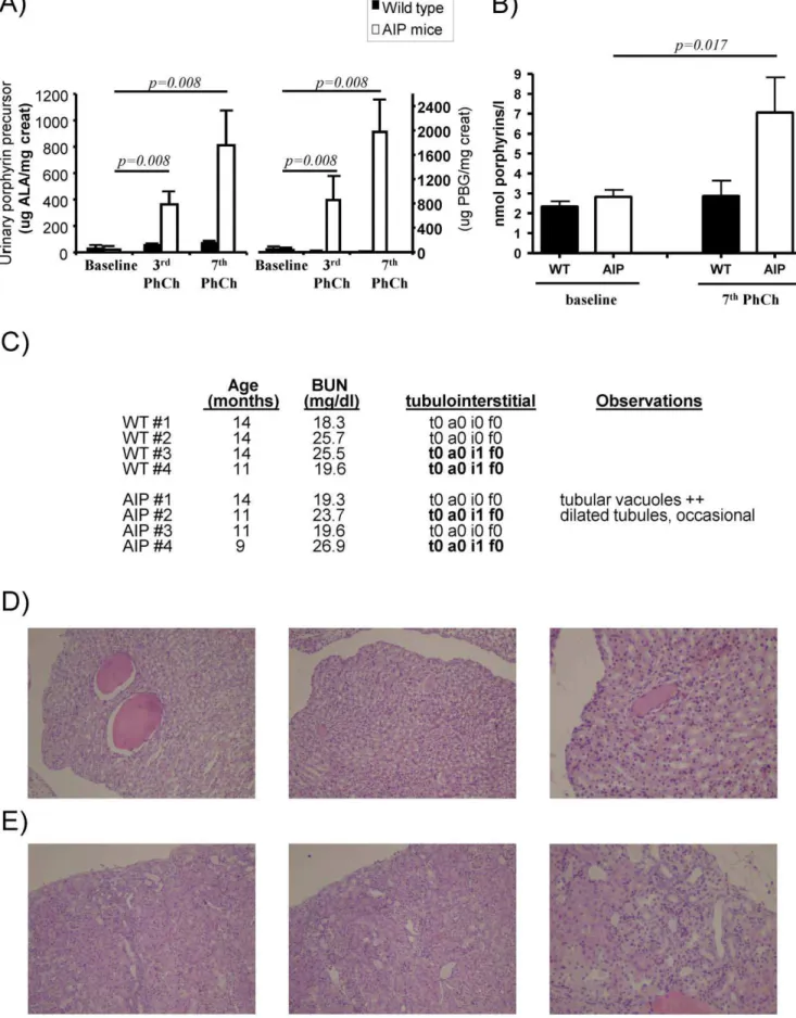 Figure 1. Lack of glomerular, tubulointerstitial or vascular damage in acute intermittent porphyria mice after sustained urinary porphyrin precursors and porphyrin excretion induced by phenobarbital challenge