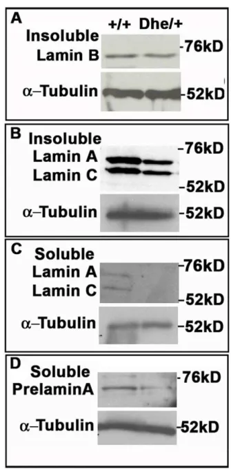 Figure 3. Lmna Dhe/+ fibroblasts exhibit lower Lamin A levels, but no change in Lamin B expression