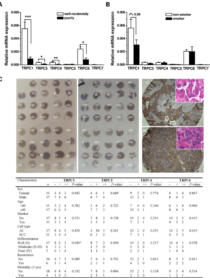 Figure 2. Correlation of TRPC expression to differentiation grade, smoking, cell type, sex and age determined by real-time PCR and immunostaining