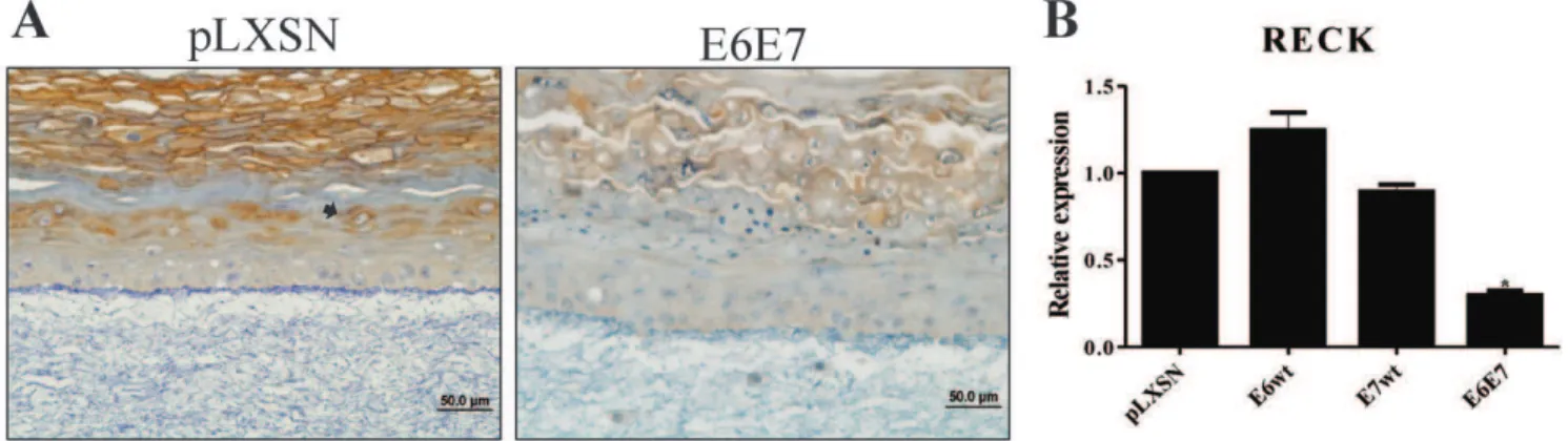 Figure 3. Expression of HPV-16 E6/E7 down-regulates RECK in organotypic cultures. A, Representative immunoreactivity of RECK in control and HPV16 E6E7 expressing rafts cultures