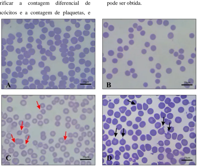 Figura  8.  Amostra  de  gatos  do  Pici,  esfregaços  de  sangue  periférico.  A)  Macrocitose,  policromasia;  B)  Anisocitose, anisocromia; C) Anisocitose, hipocromia e frequência aumentada de CHz (setas vermelhas); 