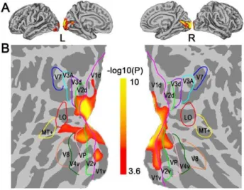 Figure 1. Comparison maps of cortical thickness between CB and SC subjects in a vertex-wise manner