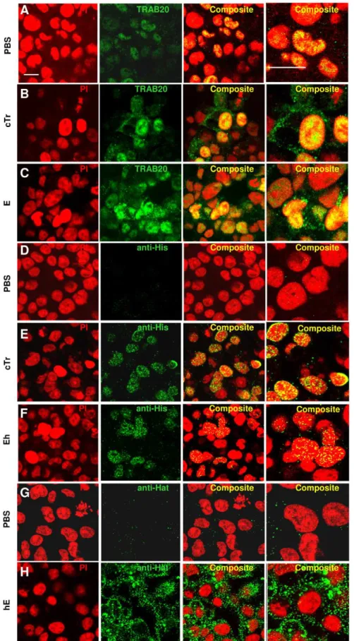 Figure 3. Cellular localization of exogenous elafin in genital epithelial cells. Immunofluorescence staining of cellular distribution of 1 mg/ml of human Tr or E (green) proteins, detected using TRAB2O (A,B,C), His-tag- (D,E,F), and HAT-tag-specific antibo