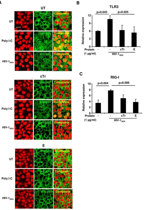 Figure 5. Elafin attenuates HIV-1-induced nuclear translocation of NF- k B and mRNA expression of TLR3 and RIG-I genes in response to R5-HIV-1 ADA 