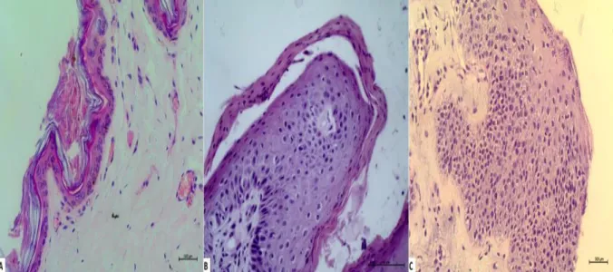 Table 1 – Absolute and relative values of alterations and inflammatory infiltrates observed in epidermis and dermis of allergic animals