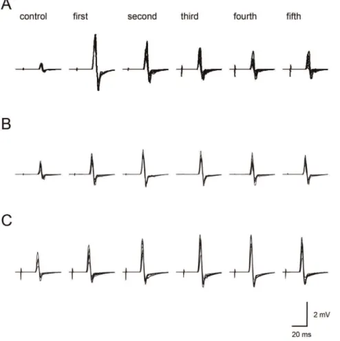 Figure 2B shows typical recordings of MEPs in the FDI obtained from a single participant