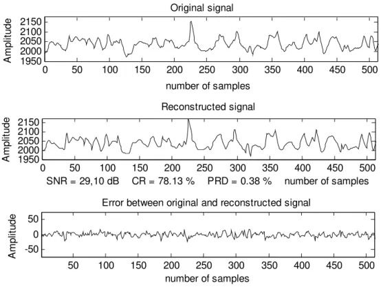 Fig. 7.  Reconstruction of EMG signal called Jouve for a pitch of 24 