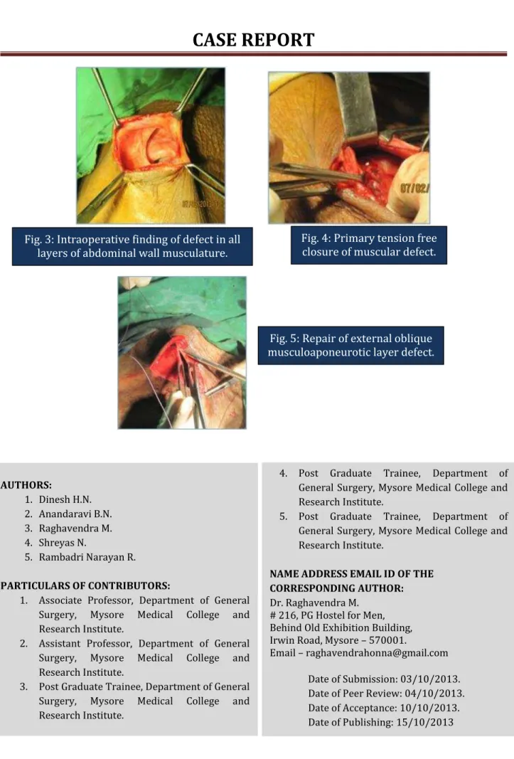 Fig. 4: Primary tension free  closure of muscular defect.