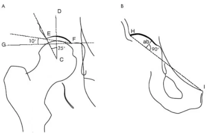 Fig. 1 A – DCE (the center-edge angle of Wiberg);