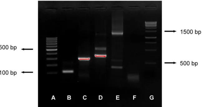 Fig 2. Image of gel showing all bands obtained with the present protocol. Image of gel showing amplification of the PCR protocols described: (A) GeneRuler 100bp DNA ladder; (B) MTC DNA IS6110 (110 bp); (C) M
