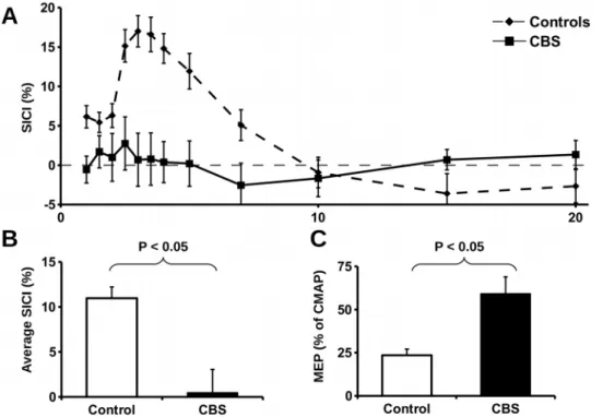 Table 3. Cortical excitability in CBS patients.