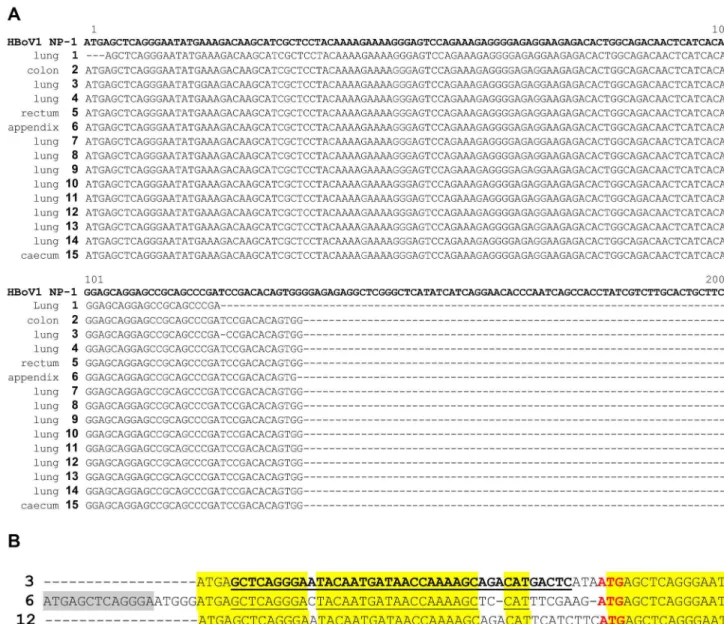 Figure  2.    This  figure  shows  selected  representative  fluorescence  microscopy  images  from  HBoV  DNA  positive  tumor samples and control cells