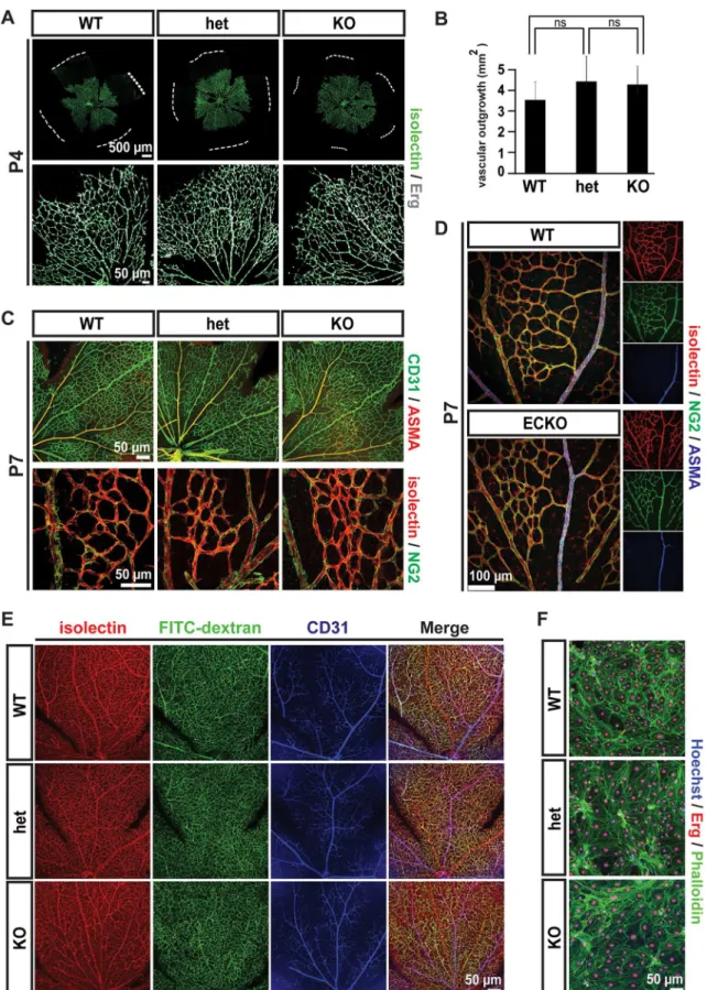 Fig 3. Retinal vascular patterning in Gpr116 -/- mice. A. Vascular network in P4 retinas