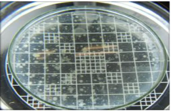 Figura 4. Placa de Petri colônias contendo fungos filamentosos e leveduras. 
