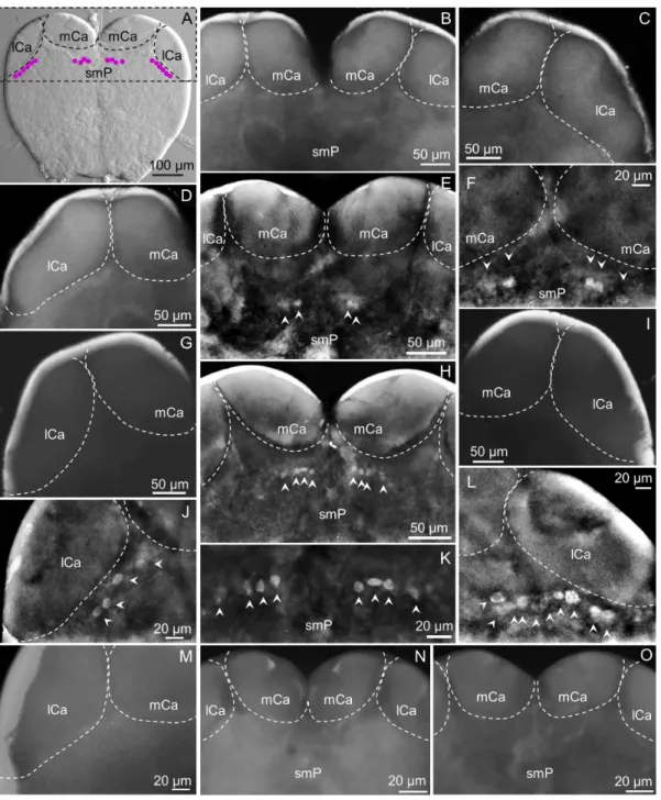 Figure 3. The superior protocerebrum exhibits differential sNPFR immunoreactive neurons among subcastes (anterior brain view).