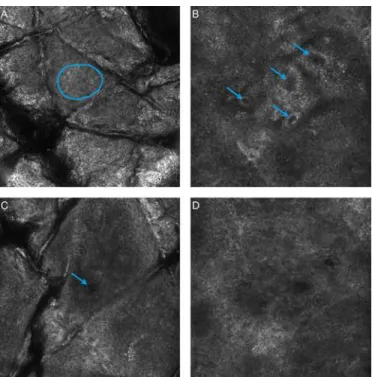 Fig 1. RCM features used in identification of the start and end of each anatomical strata