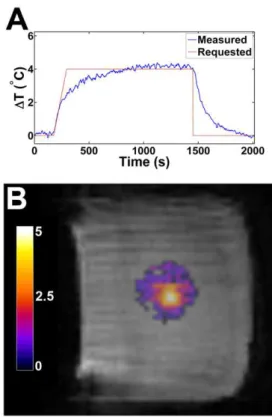 Figure 4. In vitro validation of MR-derived temperature measurements against a fluoroptic temperature probe