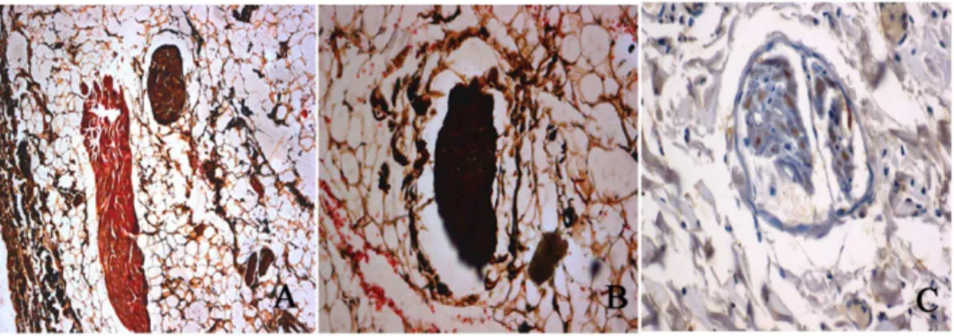 Figure 7. HE staining of the renal artery and renal nerves structures with or without ablation