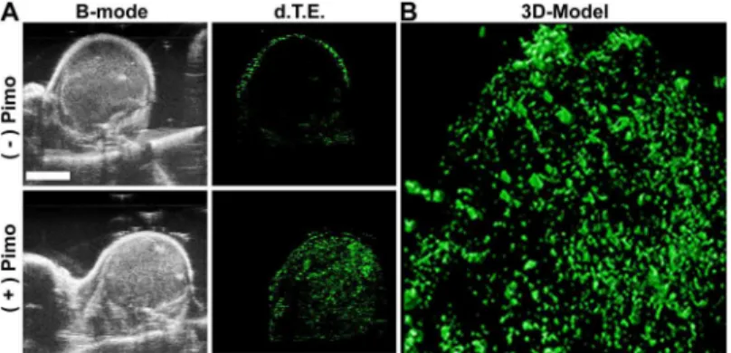 Fig 5. 3D modeling of MB α -pimo distribution in mammary gland carcinoma. A) Single slice images taken from a 3D imaging sequence in B-mode (left)