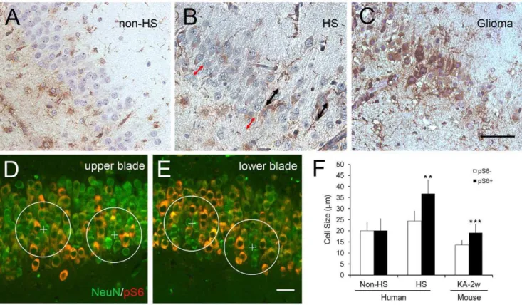 Figure 5. pS6 IR in hippocampus 2 and 5 weeks after KA-induced seizures. (A) Dispersion of granule cells is visible at 2 weeks post-SE ipsilateral (ipsi) to the KA injection (n = 4), (C) and is pronounced at 5 weeks (n = 5)