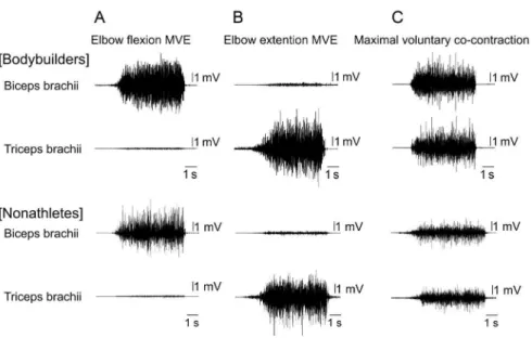 Figure 1. Example data. Example data of the EMGs of the biceps brachii (top row) and the triceps brachii (bottom row) during MVE tasks of elbow flexion (A) and elbow extension (B), and during maximal voluntary co-contraction task (C) for each of the bodybu