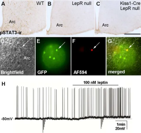 Figure 2. Lack of re-expression of functional LepR in Kiss1-Cre LepR null mice. A-C. Brightfield photomicrographs showing the distribution of leptin-induced phosphorylation of STAT3 immunoreactivity (pSTAT3-ir) in the arcuate nucleus (Arc) of wild type fem
