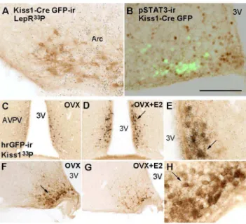Figure 5. Lack of coexpression of leptin receptor (LepR) and Kiss1 before puberty. A-F