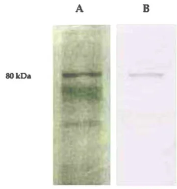 Figure 10. Determination of antibody specificity by Western blotting. A) Gel pattern of epididymal plasma (30 mg) after  DEAE-Cellulose Chromatography