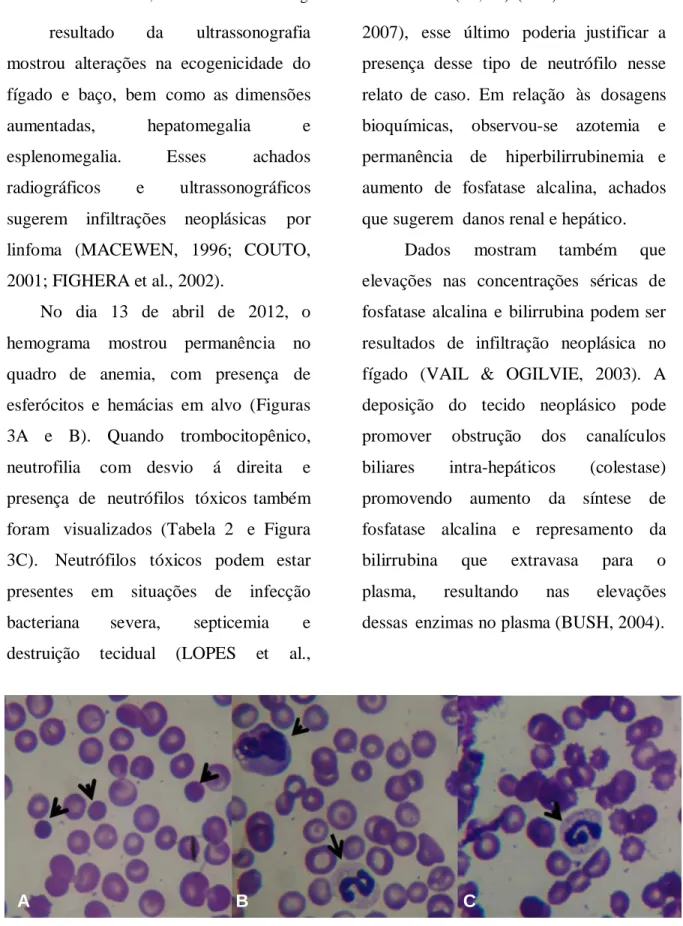 Figura  3.  Esfregaço  sanguíneo  do  dia  13  de  abril  de  2012,  mostrando  anisocitose  e  hipocromia  das  hemácias
