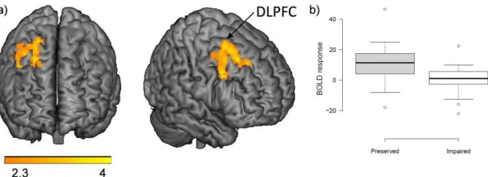 Fig 5. Brain functional changes between cognitively impaired and preserved patients. (A) Brain regions where the cognitively impaired patients showed significantly reduced activation compared with the preserved patients in the 2-back v