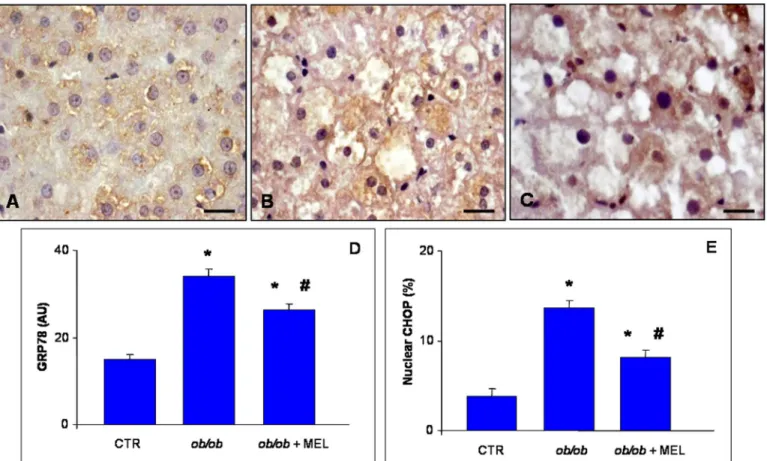 Fig 4. Liver GRP78 and CHOP immunostainings. Hepatic immunostaining for GRP78 in lean (A), ob/ob (B) and ob/ob treated with melatonin (C) mice.