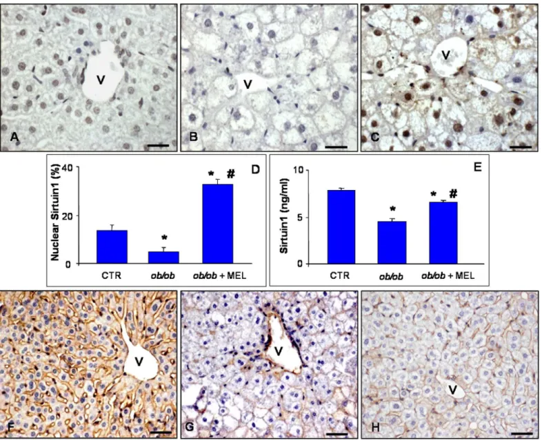 Fig 5. Liver SIRT1 and β-catenin immunostainings. Hepatic immunostaining for sirtuin 1 (A-C) and β-catenin (F-H) in lean (A, F), ob/ob (B, G) and ob/ob treated with melatonin (C, H) mice