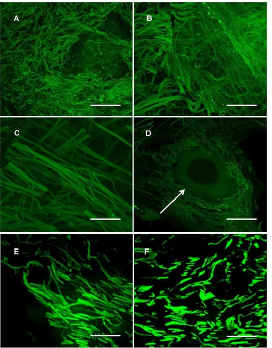 Figure 1. Confocal microscopy: (A-D) Confocal microscopy autofluorescence images of 20 mm ADM cryocuts, scale bars equal (A,C) 75 mm, (B,D) 50 mm; (D) the white arrow indicates a putative vessel channel; (E,F) autofluorescence images of 10 mm cryocuts of n