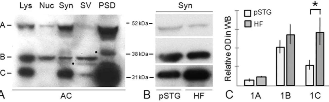Figure 5. Subsynaptic localization of dysbindin-1 isoforms. A: Western blotting results on synaptosomal (Syn), synaptic vesicle (SV), presynaptic membrane (PrS), and postsynaptic density (PSD) fractions of the normal HF from three control cases (1–3) in th