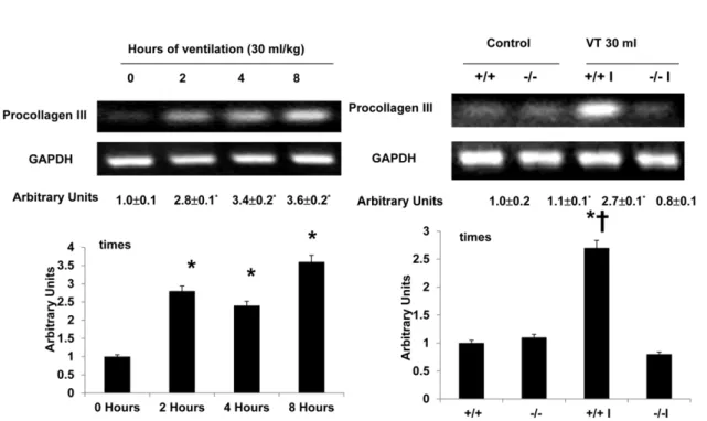 Figure 5. Lumican deficient mice reduced high tidal volume ventilation-induced type III procollagen mRNA expression in diaphragm