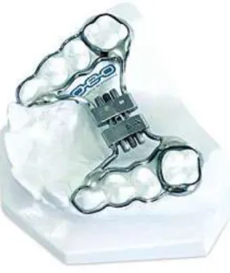Figura 5 - Aparelho Hyrax  